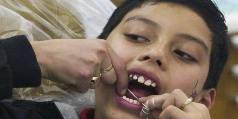 child at dentist