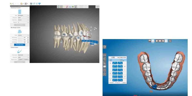 3D printing