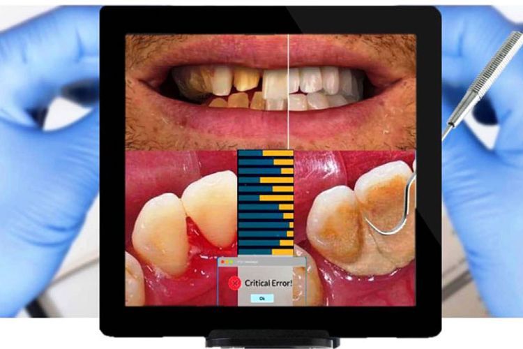 Application of augmented reality (AR) in dental plaque detection, helping the dentist distinguish between tartar and the tooth surface. Using a Piezo Scaler, the dentist removes tartar and plaque from the patient’s enamel surface. The computer informs the dentist of a critical error when the instrument scrapes beyond the plaque areas